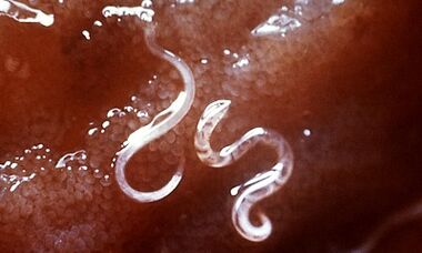 Millised parasiidid on inimestel maksas